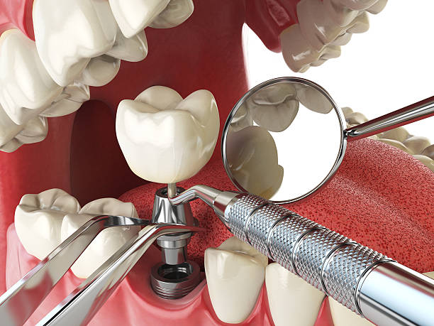 Best Emergency Gum Treatment in Enola, PA